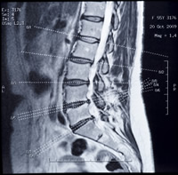 Human Spine